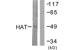 HAT Antikörper  (C-Term)