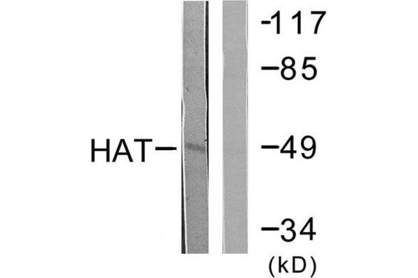 HAT Antikörper  (C-Term)