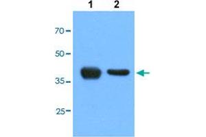 Western blot analysis of Lane 1: HepG2 cells, Lane 2: HeLa cells with ACAT1 monoclonal antibody, clone AT2C5  at 1:1000 dilution. (ACAT1 Antikörper  (AA 34-427))