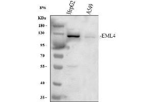 Western blot analysis of EML4 using anti-EML4 antibody (ABIN6719384). (EML4 Antikörper  (AA 207-423))