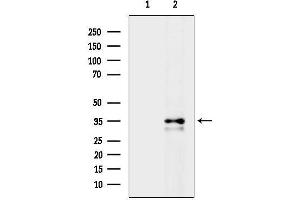 anti-Chemokine (C-C Motif) Receptor 1 (CCR1) (N-Term) antibody