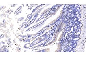 Detection of APC in Rat Small intestine Tissue using Polyclonal Antibody to Adenomatosis Polyposis Coli Protein (APC) (APC Antikörper  (AA 2634-2842))