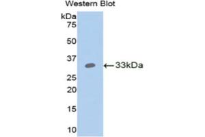 Western blot analysis of the recombinant protein. (ANGPTL4 Antikörper  (AA 183-401))