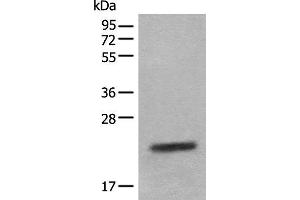 Western blot analysis of Mouse eye tissue lysate using CRYGS Polyclonal Antibody at dilution of 1:800 (CRYGS Antikörper)