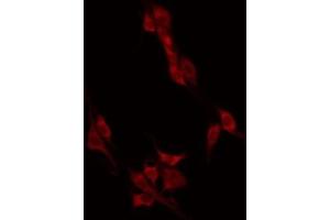 ABIN6274946 staining HT29 by IF/ICC. (CAGE1 Antikörper  (C-Term))