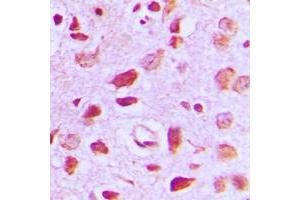 Immunohistochemical analysis of EIF5B staining in human brain formalin fixed paraffin embedded tissue section. (EIF5B Antikörper  (C-Term))