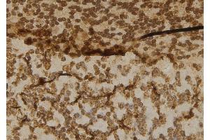 ABIN6277016 at 1/100 staining Mouse brain tissue by IHC-P. (Cbl Proto-Oncogene B, E3 Ubiquitin Protein Ligase (CBLB) (N-Term) Antikörper)