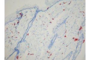 Image no. 1 for anti-Macrophages antibody (ABIN481694) (Macrophages Antikörper)