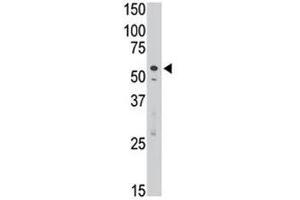 SIGLEC7 antibody used in western blot to detect Dsiglec/SIGLEC7 in Jurkat cell lysate (SIGLEC7 Antikörper  (AA 407-438))