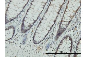Immunoperoxidase of monoclonal antibody to CLIC1 on formalin-fixed paraffin-embedded human colon. (CLIC1 Antikörper  (AA 1-241))