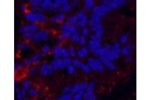 Immunofluorescence analysis of Mouse colon tissue using KIF7 Monoclonal Antibody at dilution of 1:200. (KIF7 Antikörper)