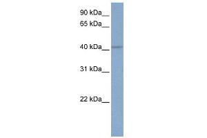 KCNN4 antibody used at 1 ug/ml to detect target protein. (KCNN4 Antikörper  (C-Term))