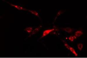 ABIN6278583 staining  HuvEc cells by IF/ICC. (IP6K2 Antikörper  (Internal Region))