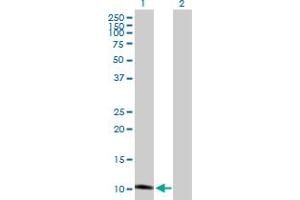 Western Blot analysis of GHRH expression in transfected 293T cell line by GHRH MaxPab polyclonal antibody. (GHRH Antikörper  (AA 1-108))