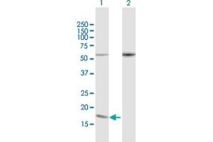 Western Blot analysis of PDCD5 expression in transfected 293T cell line by PDCD5 MaxPab polyclonal antibody. (PDCD5 Antikörper  (AA 1-125))