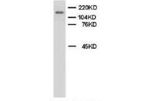 Western blot analysis of rat brain tissue lysis using Myeloperoxidase antibody (Myeloperoxidase Antikörper  (C-Term))