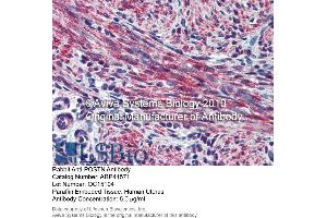Immunohistochemistry (IHC) image for anti-Periostin (POSTN) (Middle Region) antibody (ABIN2776883)