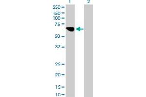 Western Blot analysis of MLYCD expression in transfected 293T cell line by MLYCD MaxPab polyclonal antibody.