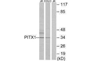 Western blot analysis of extracts from Jurkat cells and COLO cells, using PITX1 antibody. (PITX1 Antikörper  (Internal Region))