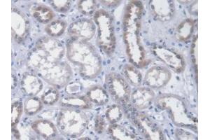 DAB staining on IHC-P; Samples: Human Kidney Tissue (ICA1 Antikörper  (AA 1-258))