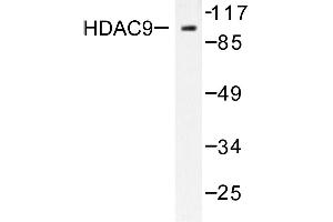 Image no. 2 for anti-Histone Deacetylase 9 (HDAC9) antibody (ABIN265461) (HDAC9 Antikörper)