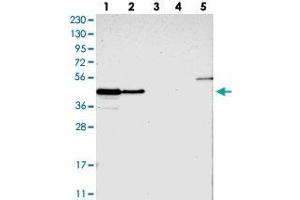 Western blot analysis of Lane 1: RT-4, Lane 2: U-251 MG, Lane 3: Human Plasma, Lane 4: Liver, Lane 5: Tonsil with PAWR polyclonal antibody  at 1:250-1:500 dilution. (PAWR Antikörper)