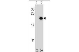 Western blot analysis of EIF4EBP1 (arrow) using rabbit polyclonal EIF4EBP1 Antibody (Center) (ABIN656558 and ABIN2845820). (eIF4EBP1 Antikörper  (AA 31-61))