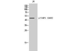 Western Blotting (WB) image for anti-C-terminal Binding Protein 1 (CTBP1) (pSer422) antibody (ABIN3182694) (CTBP1 Antikörper  (pSer422))