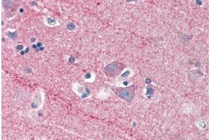 Human Brain, Cortex (formalin-fixed, paraffin-embedded) stained with ICAM5 antibody ABIN337181 at 5 ug/ml followed by biotinylated anti-goat IgG secondary antibody ABIN481715, alkaline phosphatase-streptavidin and chromogen. (ICAM5 Antikörper  (AA 909-920))