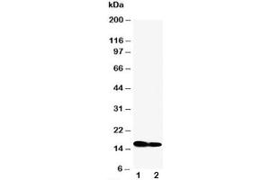 Western blot testing of IFITM1 antibody and Lane 1:  SW620 (IFITM1 Antikörper  (N-Term))