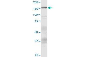 Western Blotting (WB) image for anti-Additional Sex Combs Like 1 (ASXL1) (AA 1-84) antibody (ABIN792966) (ASXL1 Antikörper  (AA 1-84))
