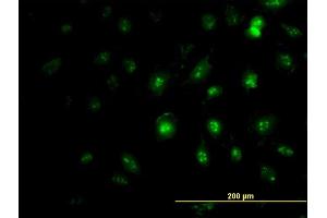 Immunofluorescence of monoclonal antibody to ZIC4 on HeLa cell. (ZIC4 Antikörper  (AA 249-319))