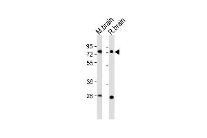 All lanes : Anti-Nr4a2 Antibody (Center) at 1:2000 dilution Lane 1: mouse brain lysates Lane 2: rat brain lysates Lysates/proteins at 20 μg per lane. (NR4A2 Antikörper  (AA 164-197))