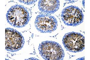 IHC analysis of DDX4 using anti-DDX4 antibody (ABIN7601203).