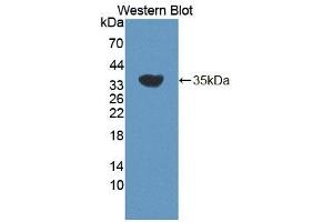 Detection of Recombinant ERRb, Mouse using Polyclonal Antibody to Estrogen Related Receptor Beta (ERRb) (ESRRB Antikörper  (AA 166-438))
