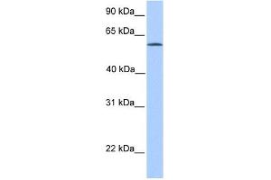 ACSBG2 antibody used at 1 ug/ml to detect target protein.