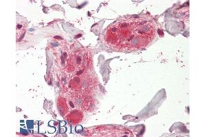 Immunohistochemistry (IHC) image for anti-Cholinergic Receptor, Nicotinic, alpha 5 (Neuronal) (CHRNA5) (Internal Region) antibody (ABIN768569)