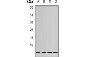 Western blot analysis of MIF expression in HEK293T (A), 22RV1 (B), Hela (C), HepG2 (D) whole cell lysates. (MIF Antikörper)