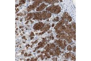 Immunohistochemical staining of human stomach with ADNP2 polyclonal antibody  shows strong cytoplasmic positivity in glandular cells at 1:20-1:50 dilution.