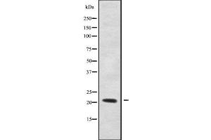 Western blot analysis of RHOXF1 using LOVO whole cell lysates (RHOXF1 Antikörper  (Internal Region))