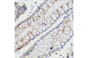 Immunohistochemistry of paraffin-embedded human rectum using CHMP4B antibody (ABIN5975521) at dilution of 1/100 (40x lens). (CHMP4B Antikörper)