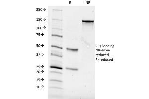 SDS-PAGE Analysis Purified CD84 Mouse Monoclonal Antibody (153-4D9). (CD84 Antikörper)