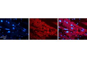 Rabbit Anti-PCCA Antibody   Formalin Fixed Paraffin Embedded Tissue: Human heart Tissue Observed Staining: Cytoplasmic Primary Antibody Concentration: N/A Other Working Concentrations: 1:600 Secondary Antibody: Donkey anti-Rabbit-Cy3 Secondary Antibody Concentration: 1:200 Magnification: 20X Exposure Time: 0.