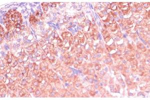 Immunohistochemistry of paraffin-embedded Mouse adrenal gland using CYP11B2 Polyclonal Antibody at dilution of 1:100 (40x lens). (CYP11B2 Antikörper)