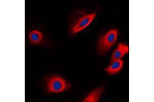 Immunofluorescent analysis of PTP1B staining in SKNSH cells. (PTPN1 Antikörper  (N-Term))