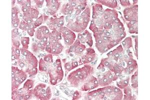 Human Pancreas: Formalin-Fixed, Paraffin-Embedded (FFPE). (CCL15 Antikörper  (AA 22-113) (Biotin))