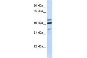 Image no. 1 for anti-Hyaluronidase-1 (HYAL1) (AA 72-121) antibody (ABIN6743572) (HYAL1 Antikörper  (AA 72-121))
