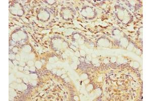 Immunohistochemistry of paraffin-embedded human small intestine tissue using ABIN7173950 at dilution of 1:100 (Type 2 Phosphatidylinositol 4,5-Bisphosphate 4-Phosphatase (PIP4P2) (AA 1-191) Antikörper)