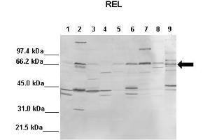 WB Suggested Anti-REL Antibody  Positive Control: Lane1: 100ug mouse liver, Lane2: 100ug mouse brain, Lane3: 100ug mouse heart, Lane4: 100ug mouse kidney, Lane5: 100ug mouse lung, Lane6: 100ug mouse thymus, Lane7: 100ug mouse spleen, Lane8: 100ug mouse testis, Lane9: 100ug mouse HeLa  Primary Antibody Dilution :  1:1000 Secondary Antibody :  Anti-rabbit-AP  Secondry Antibody Dilution :  1:10,000 Submitted by: Andreia Carvalho, Instituto de Biologia Molecular e Celular, Universidade do Porto (IBMC-UP) (c-Rel Antikörper  (Middle Region))