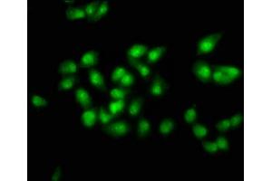 Immunofluorescence staining of ntera-2 cells with ABIN7172619 at 1:100, counter-stained with DAPI. (SOX21 Antikörper  (AA 25-126))
